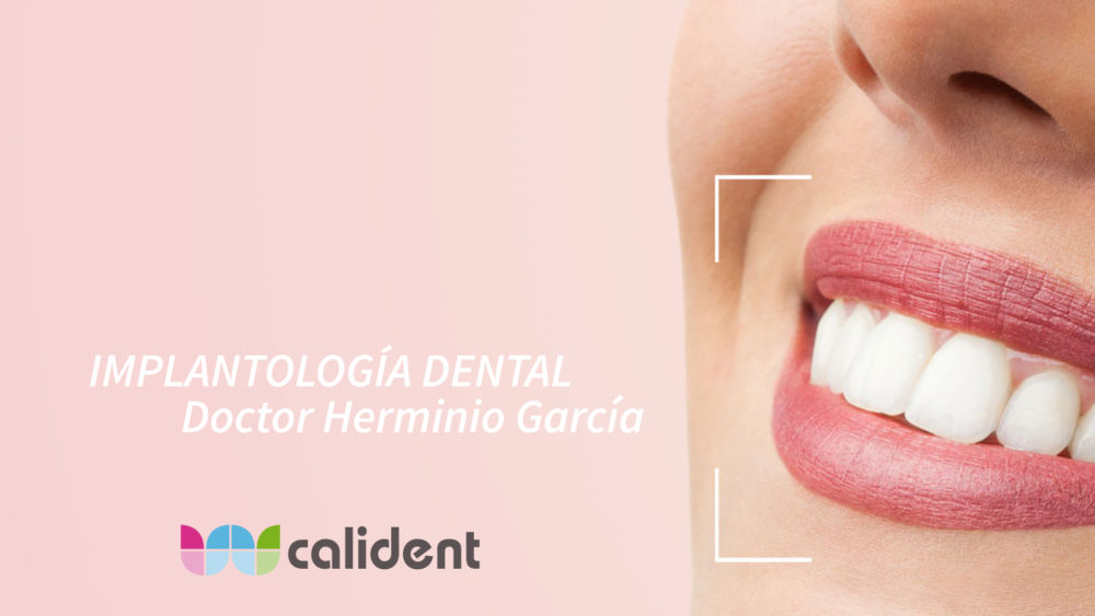 Implantes dentales Sitges Clinica Dental