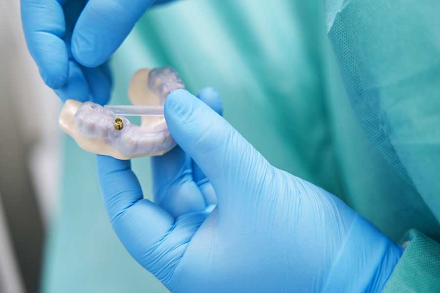 Beneficios de los implantes dentales: Restaurando Sonrisas y Mejorando la Calidad de Vida